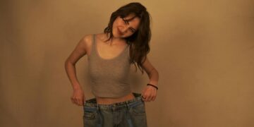 did hally vogel have weight loss surgery