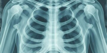 result of ct scan how long