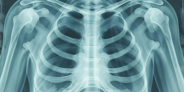 result of ct scan how long